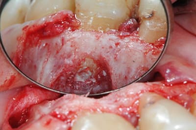 Dsc 5005 bjp03r - Eugenol