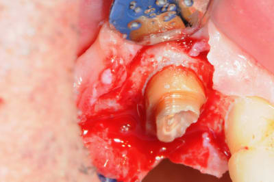 Dsc 5076 aiezjc - Eugenol