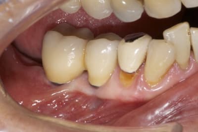 Dsc 5192 hlxolv - Eugenol