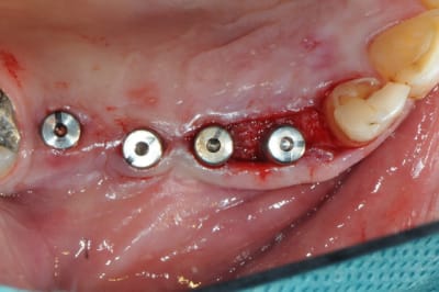 Dsc 5541 r4vg3y - Eugenol