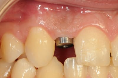 Dsc 5561 vv00ff - Eugenol