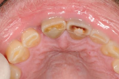Dsc 5621 cpdqfk - Eugenol
