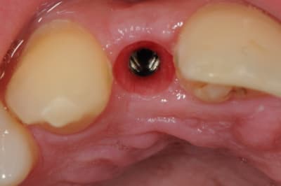 Dsc 5681 kjnwwu - Eugenol