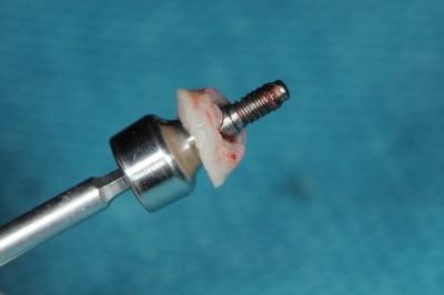 Dsc 5905 rehnwe - Eugenol