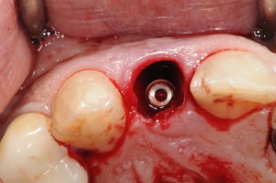 Dsc 5998 gbvkss - Eugenol