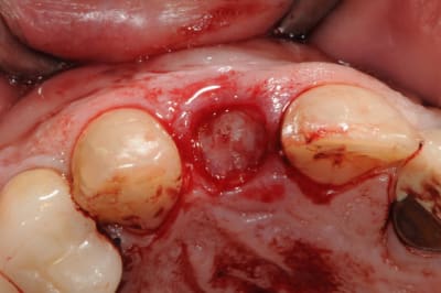 Dsc 6003 yiw5lg - Eugenol