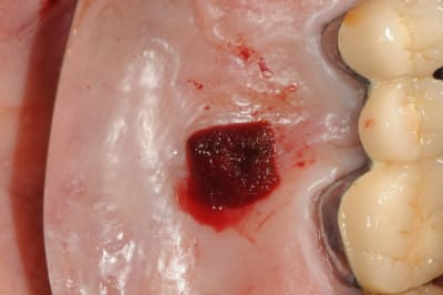 Dsc 6004 ptnxgm - Eugenol