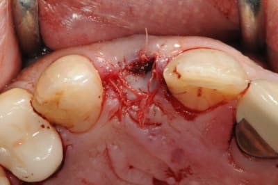 Dsc 6005 ymkhcg - Eugenol