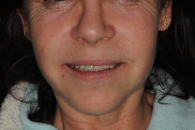 Dsc 6383 kskkui - Eugenol