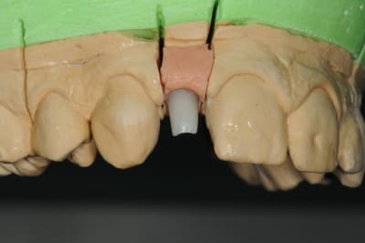 Dsc 6404 nhlxzj - Eugenol