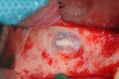Dsc 6411 yzw55t - Eugenol