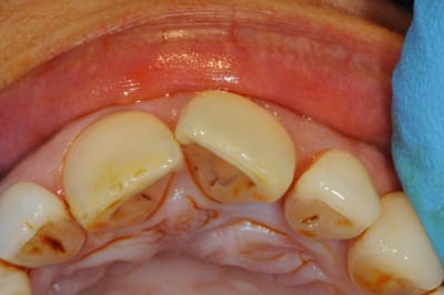 Dsc 6465 l4o2p2 - Eugenol