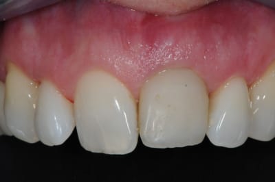 Dsc 6520 f6pqxq - Eugenol