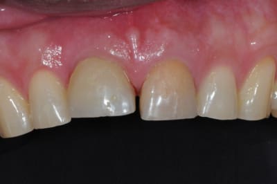 Dsc 6989 efjxtr - Eugenol