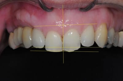 Dsc 7104apr s itmrkw - Eugenol
