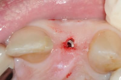 Dsc 7337 flasw0 - Eugenol