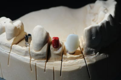 Dsc 7514 x10xun - Eugenol