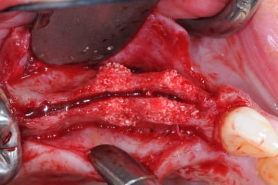 Dsc 7717 ytw8dq - Eugenol