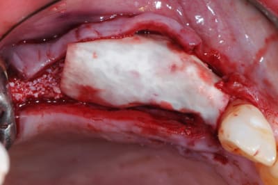 Dsc 7725 x6uh5l - Eugenol