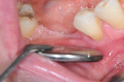 Dsc 7788 mgexhf - Eugenol