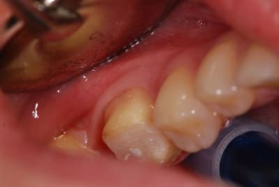 Dsc 7914 dxh45l - Eugenol