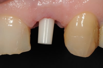 Dsc 8018 jwygjf - Eugenol