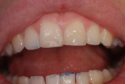 Dsc 8172s ofleeg - Eugenol