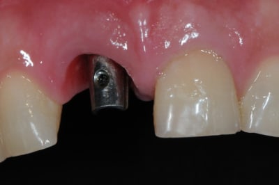 Dsc 8366 b382jp - Eugenol