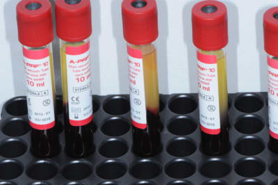 Dsc 8561 fgt8jp - Eugenol