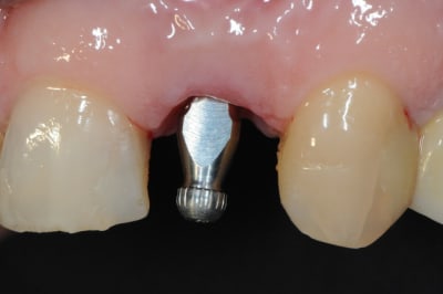 Dsc 9090 v908dg - Eugenol