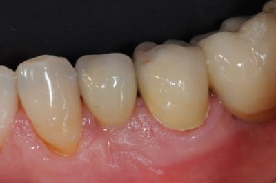 Dsc 9272 qfpvqc - Eugenol