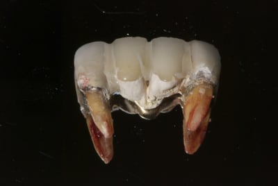 Dsc 9924 enqu6p - Eugenol