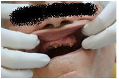 Dalbo rotex rm1uqa - Eugenol