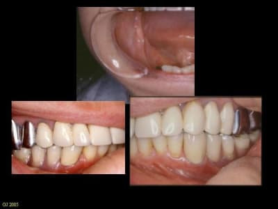 Diapositive13 zzj0vy - Eugenol