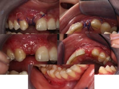 Diapositive1 ckwjug - Eugenol