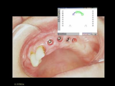 Diapositive1 d3auhw - Eugenol