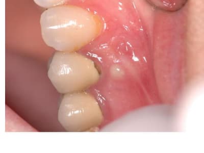 Diapositive1 fikgpk - Eugenol