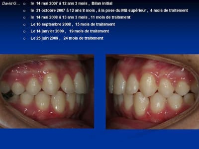 Diapositive7 nf14bu - Eugenol