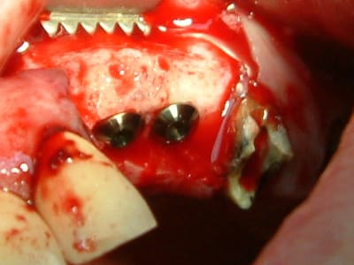 Dscf0090 opetcn - Eugenol