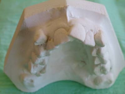 Dscf0305 lyz8uh - Eugenol