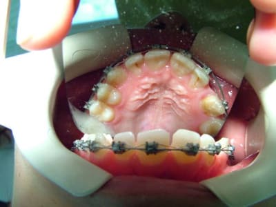 Dscf1313 jhe0bj - Eugenol