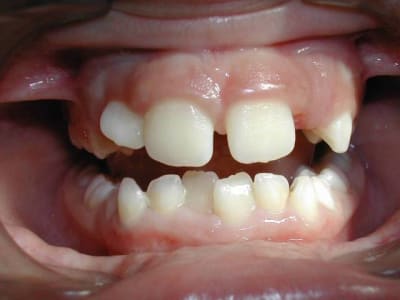 Dscn1903 an6wvc - Eugenol