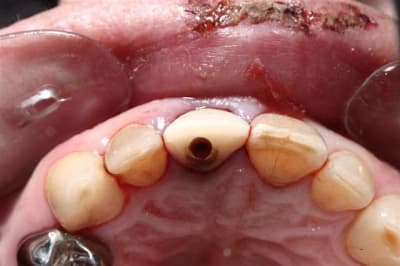 Eimic  5   large  fosz9k - Eugenol