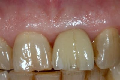 Eimic  8   large  jqwvma - Eugenol
