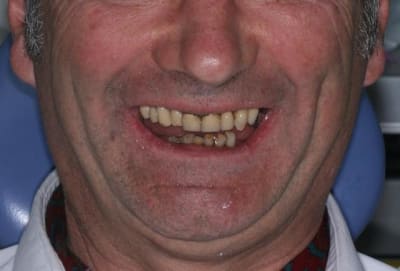 Ep vue sourire cdfkz5 - Eugenol