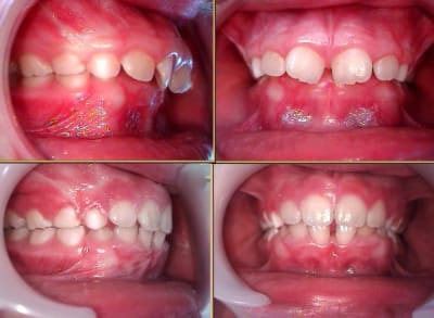 Exemple supra sb vafkci - Eugenol