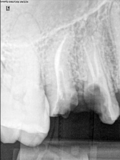 Exercice l5cfd7 - Eugenol