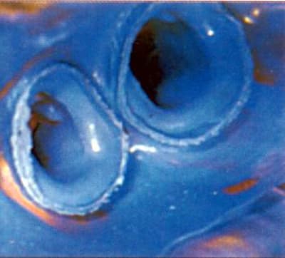 Empreinte1 ziahsr - Eugenol