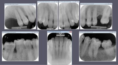 Exemplevistascan fuvkh7 - Eugenol