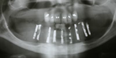 Fhlor avant greffe iqxefb - Eugenol